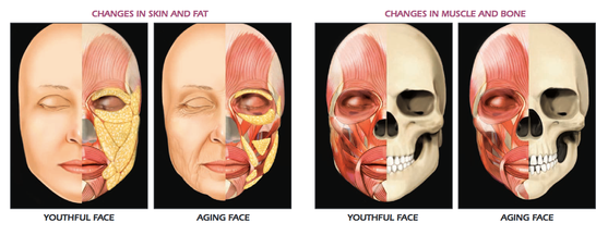 Alterações faciais no envelhecimento